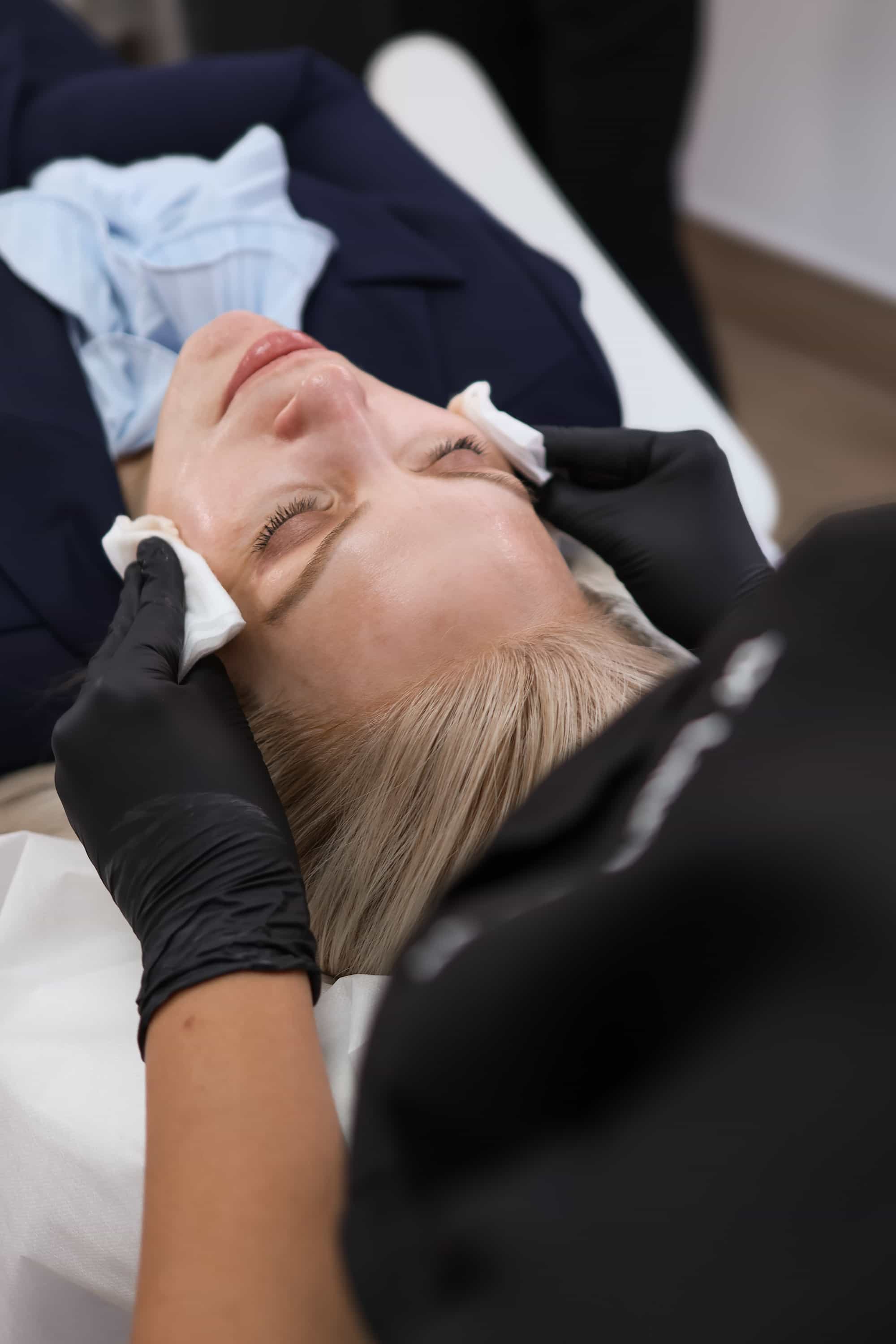 Skin Pen Microneedling near Hascombe, Surrey